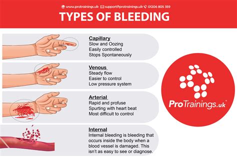 Overview of Bleeding Caused by Abnormal Blood Vessels .